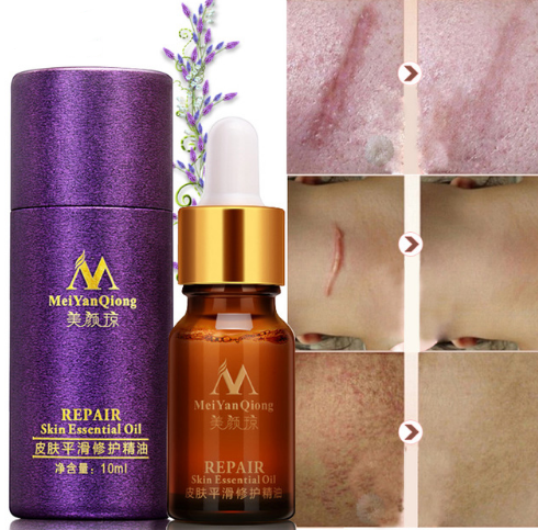 Scar Skin Repair Essential Oil - 10 ML
