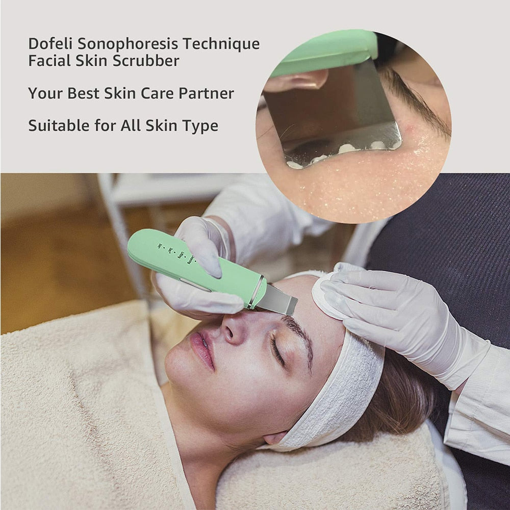 Beauty Ultrasonic Skin Scrubber with USB - your-beauty-matters