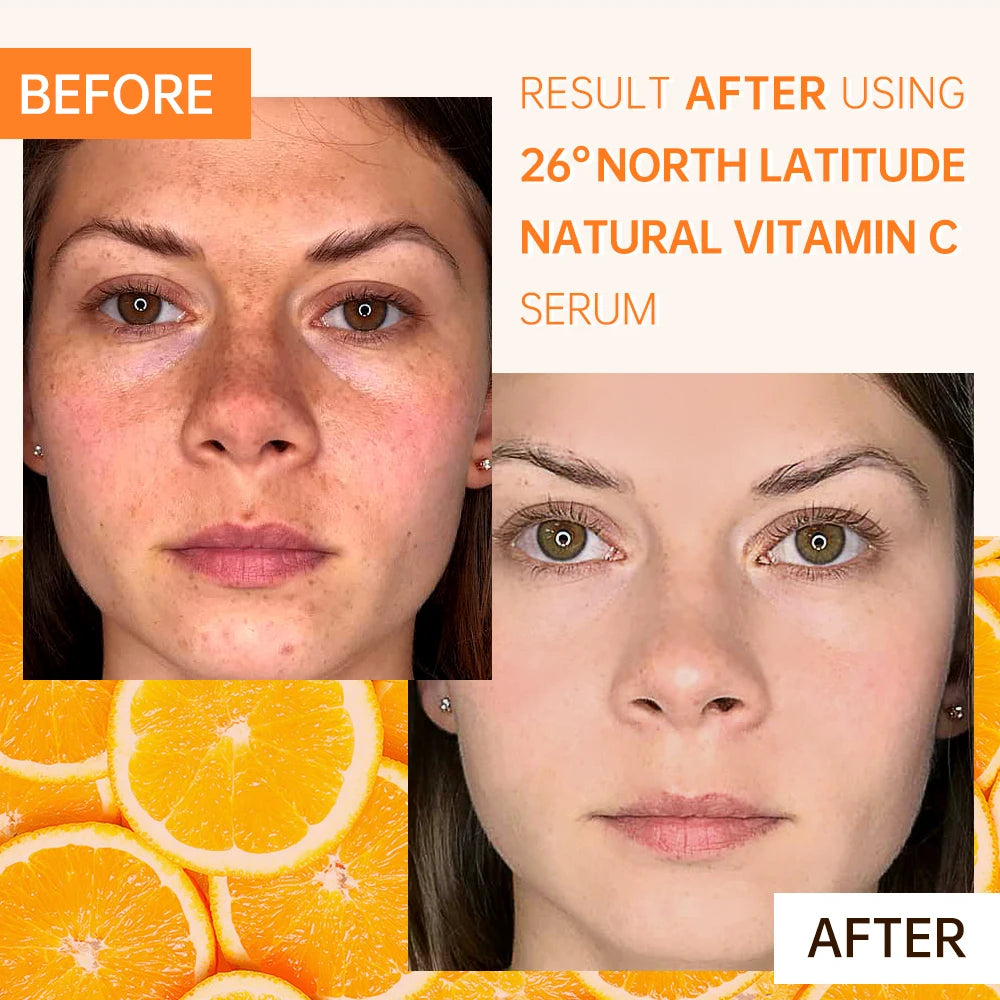 Vitamin C Face Full Skin Care Set